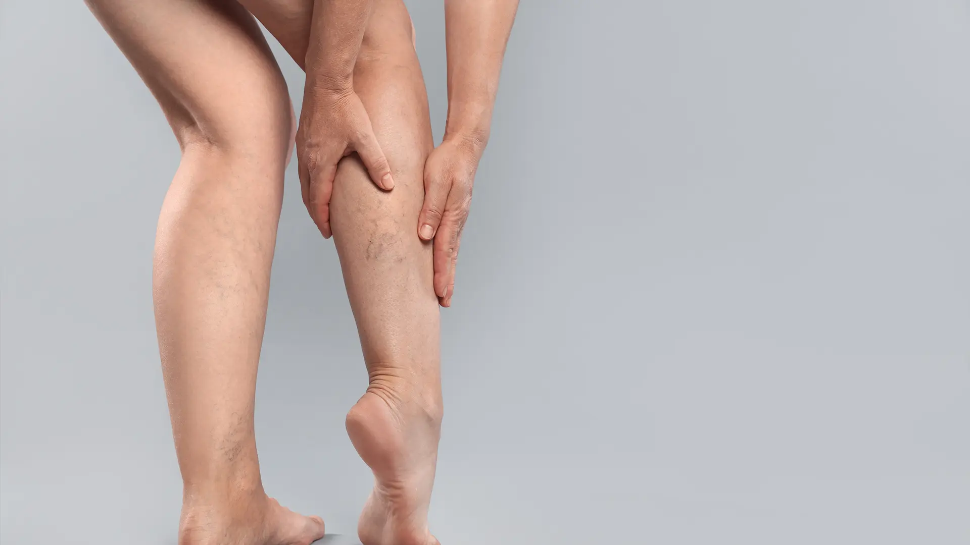 Dr. Mihai Lupu: Aproape jumătate dintre femei au o anumită formă de vene varicoase