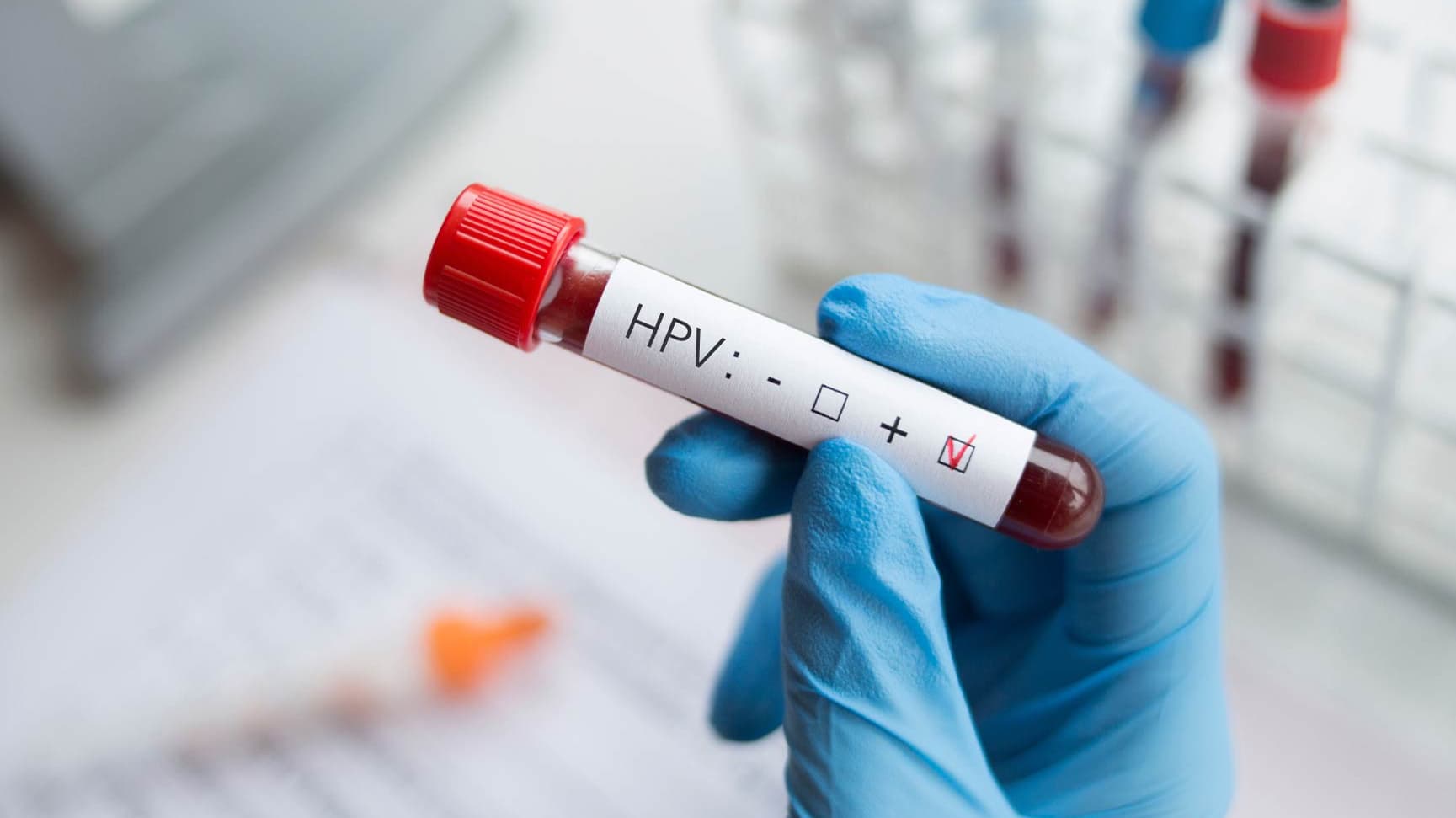 Tot ce trebuie să știi despre HPV. Sfaturi medicale de la dr. George Diaconu